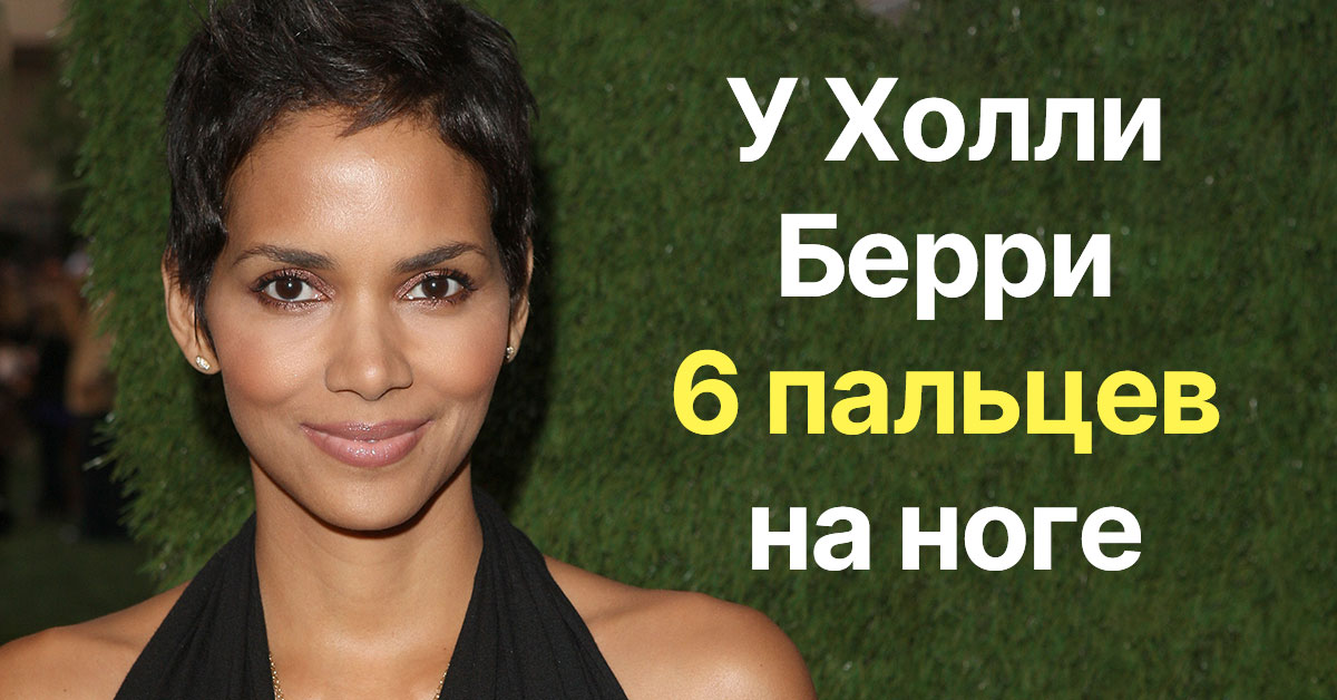 Дефекты знаменитостей: большинство не скрывает их